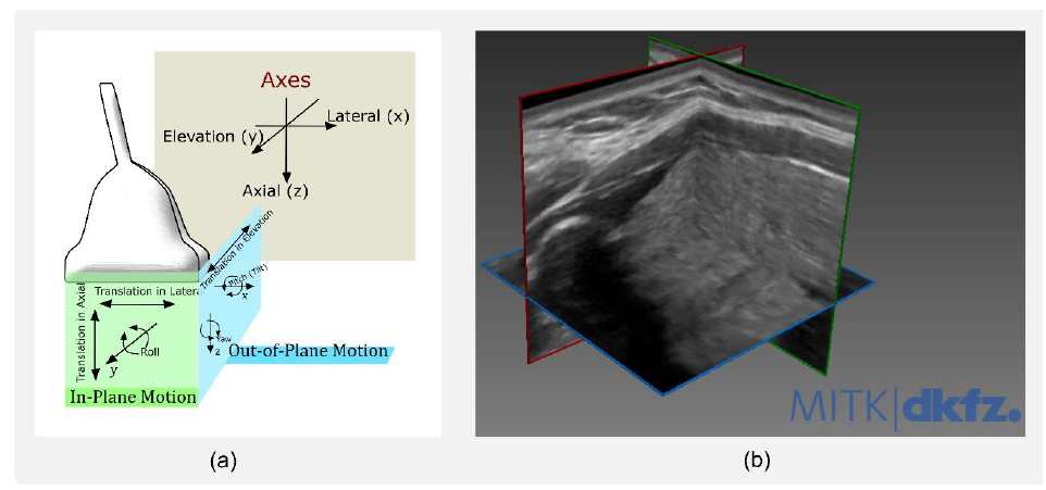 3D freehand ultrasound reconstruction from orthogonal B-mode planes, alongside the probe's six degrees of motion freedom used for PSF characterization.
